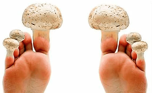Champignon sur les ongles