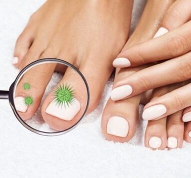 Infection des ongles par une loupe