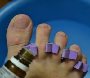 Préparation pour traiter les ongles avec des gouttes antifongiques