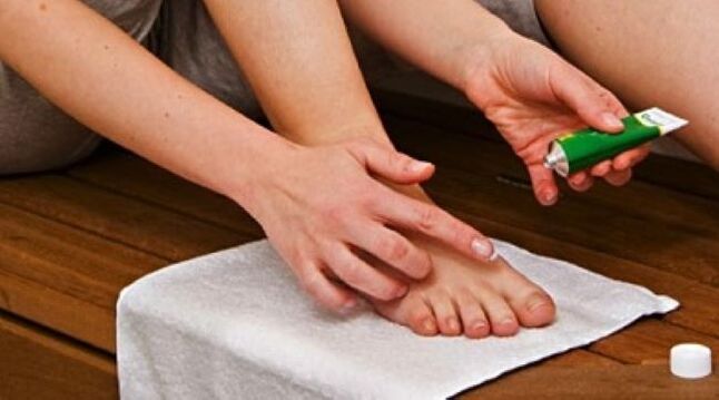 Traiter la mycose des ongles avec une pommade